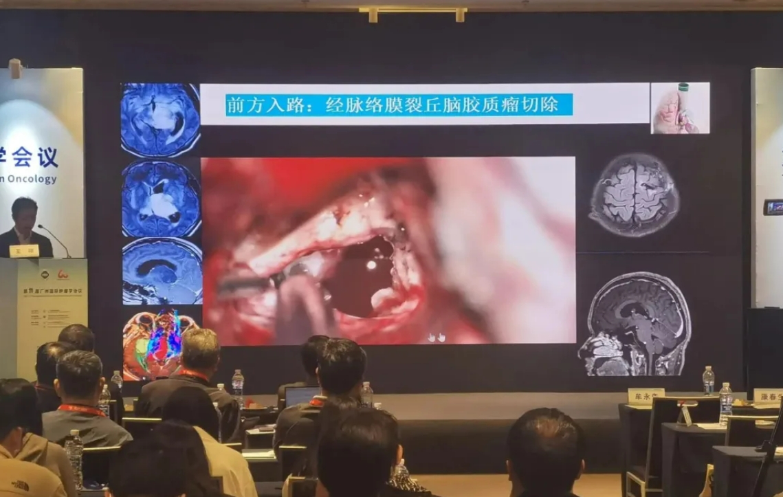 钨金针型电极、刮吸照明电极等产品参展2024第十一届昭通国际肿瘤学会议